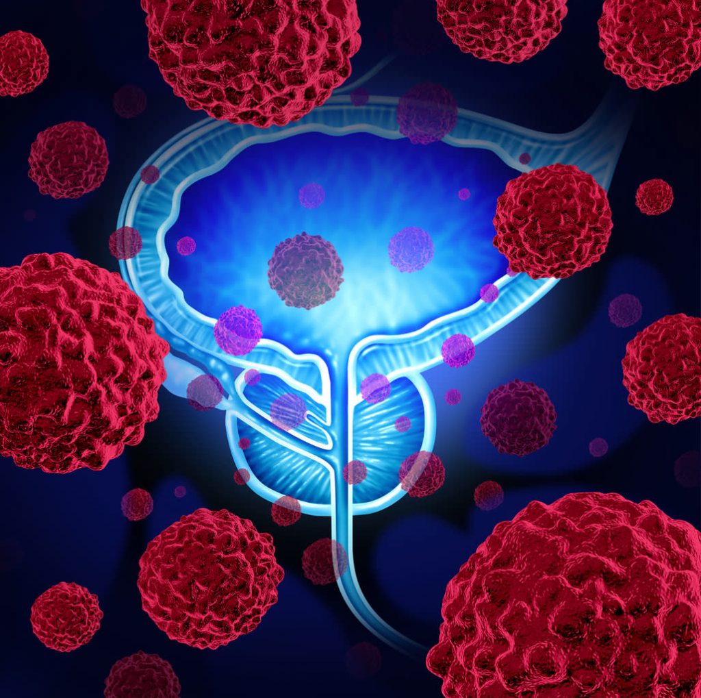 Immunotherapy for bladder cancer